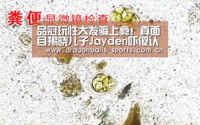  赛事数据直播